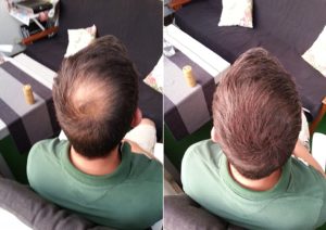 Die Handhabung vom Haarpuder Testsieger im Test und Vergleich